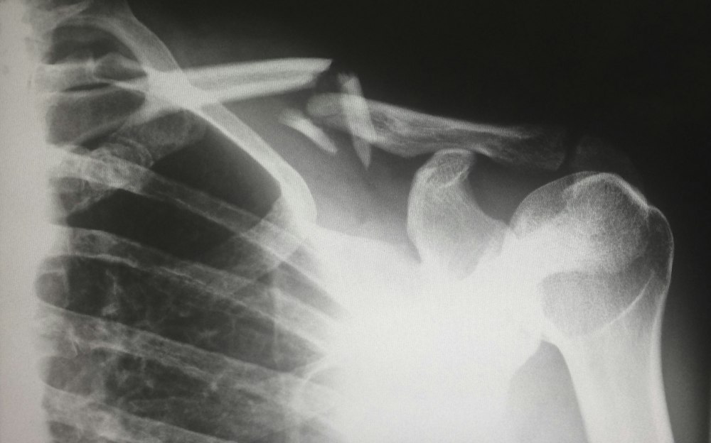 Radiology X-ray scan being reviewed